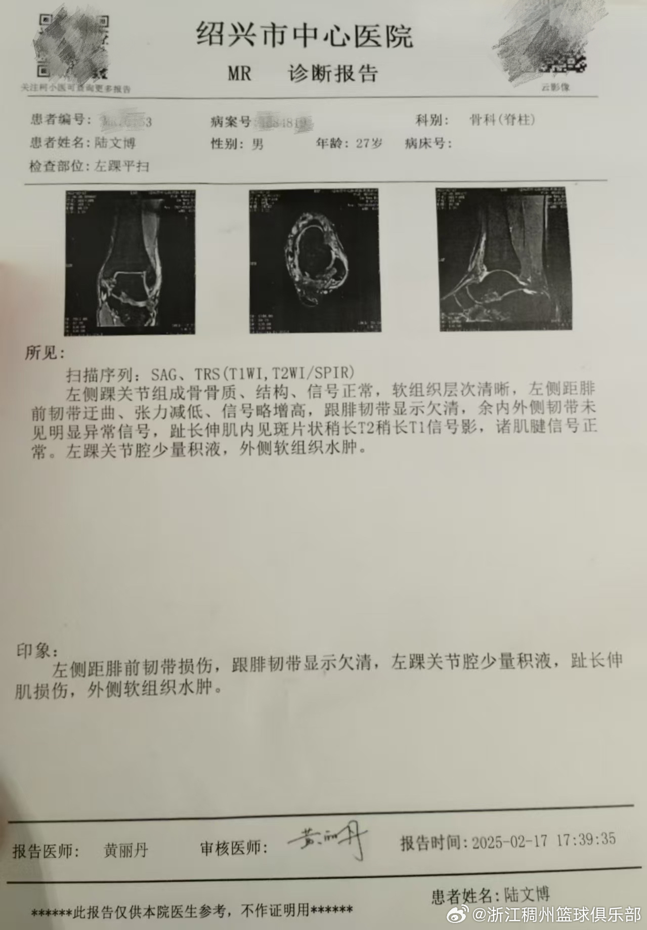 力鍛煉和輔